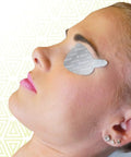 Game Changing Disposable Laser Eye Shields on a patient, providing eye protection with a pressure sensitive fit.