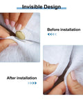 40 Piece Sew In Magnetic Snap Closures For Thin Fabric Up To 2 Mm, showing installation process on light fabric.