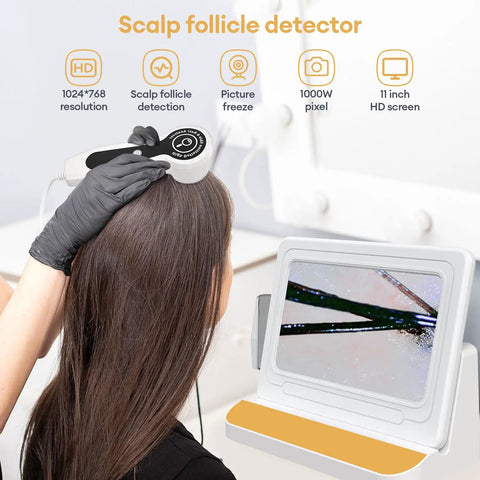 11 Inch HD Scalp Analysis Machine With 50x And 200x Lenses Digital Scalp Microscope used on hair, showing follicle detail on screen
