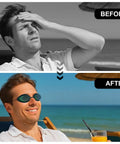 Before and after image of man using Total Game Changing IPL Eye Shields For Beauty And Spa Procedures Featuring Crazy Comfy Silicone Cushions.