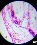 Microscope view at 600X magnification from Beginner Friendly Hands On Educational Microscope Kit for Kids With Metal Arm and Stage, 40 Piece Set, Includes 120X 240X 300X 480X 600X 1200X Magnifications, Built In LED And Mirror Illumination, Rotating Color Filter Wheel, Plus Guide Book.