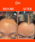Before and after results using Lace Melting Spray For Wigs With Extra Hold No Residue Bond Adhesive Ashy Lace Eliminator Game Changer.