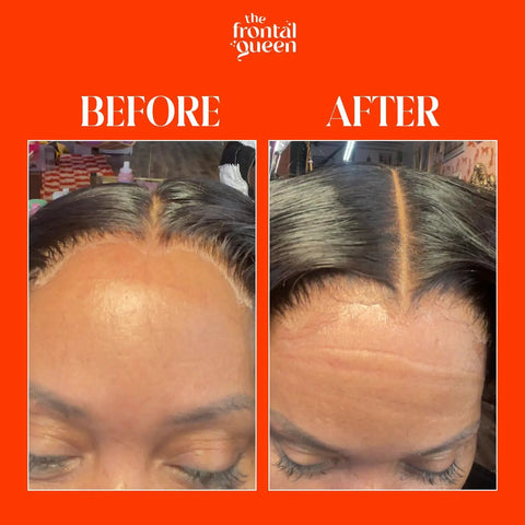Before and after results using Lace Melting Spray For Wigs With Extra Hold No Residue Bond Adhesive Ashy Lace Eliminator Game Changer.