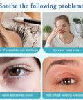 30Pcs Tea Tree Oil Eyelid Cleansing Wipes; individually wrapped travel-size eye care for dry eyes — collage views