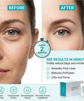 Instant Face Lift Cream For Anti Aging Skin Care That Lifts And Tightens Smooths Wrinkles Banishes Puffy Under Eye Bags No Eye Patches Needed Quick At Home Facelift In A Box Of 25 Vials before and after results